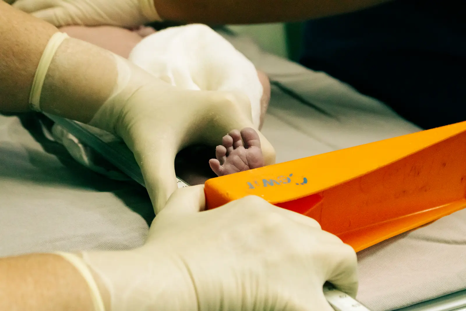 28 out of 100 newborns die in CAR, health ministry says