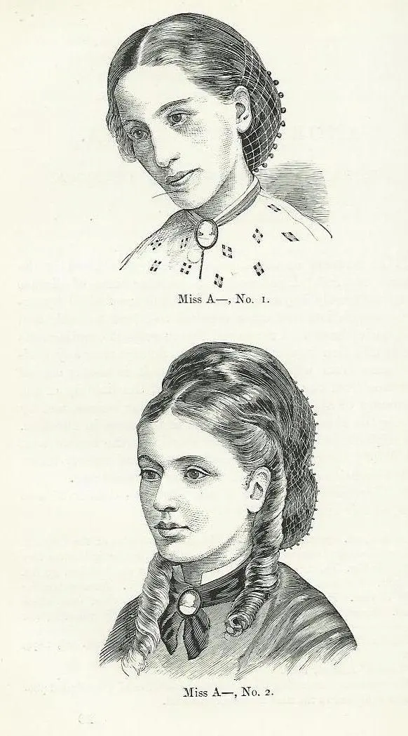 Anorexie mentale — illustration